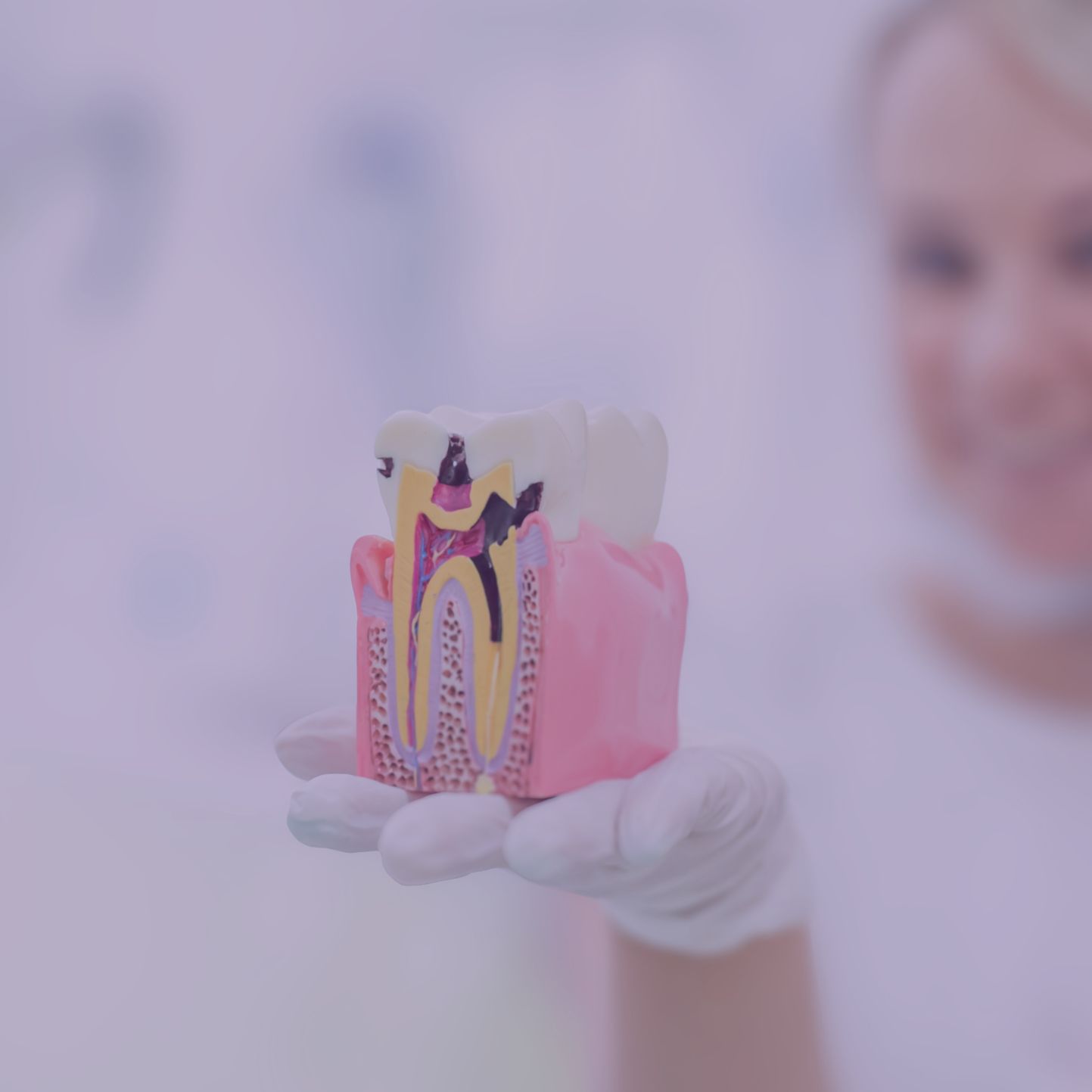 Root canal treatment